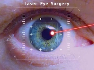 عمل لیزری چشم